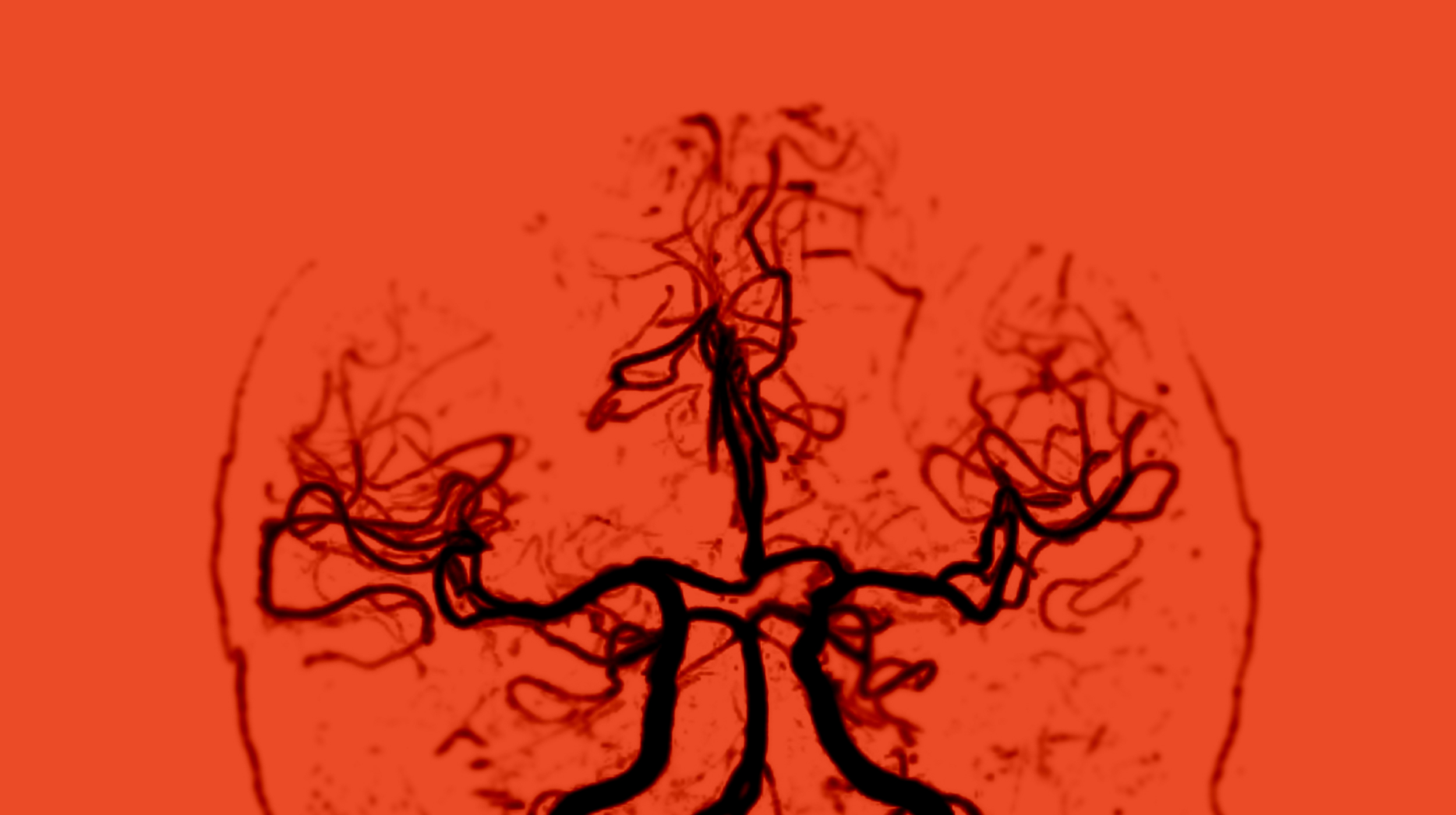 Black cerebral blood vessels are shown against a red background, resembling a brain scan or angiogram image.