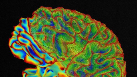 A faux MRI image showcases the impact of fake memories on the human brain.