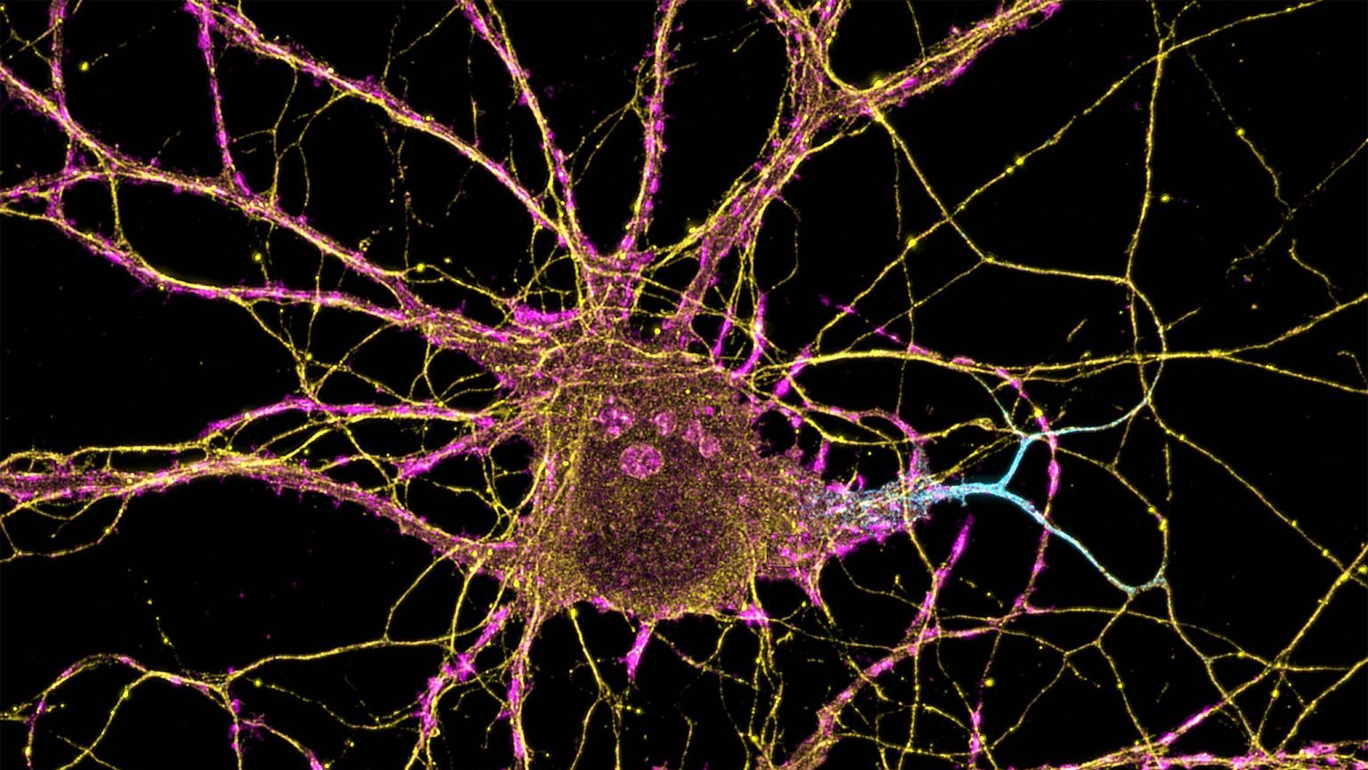 A picture of a neuron with blue and yellow lights.