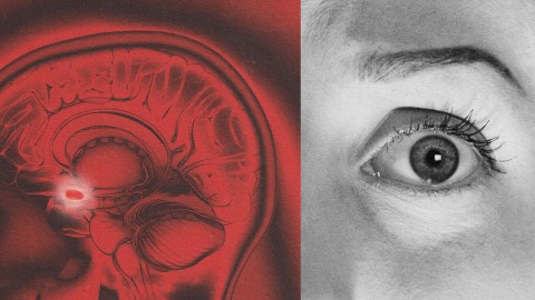 An image of a woman's eye exhibiting signs of amygdala hijack.