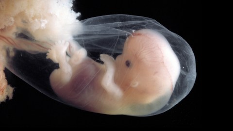 An image of a fetus in an incubator, showcasing the delicate growth process.