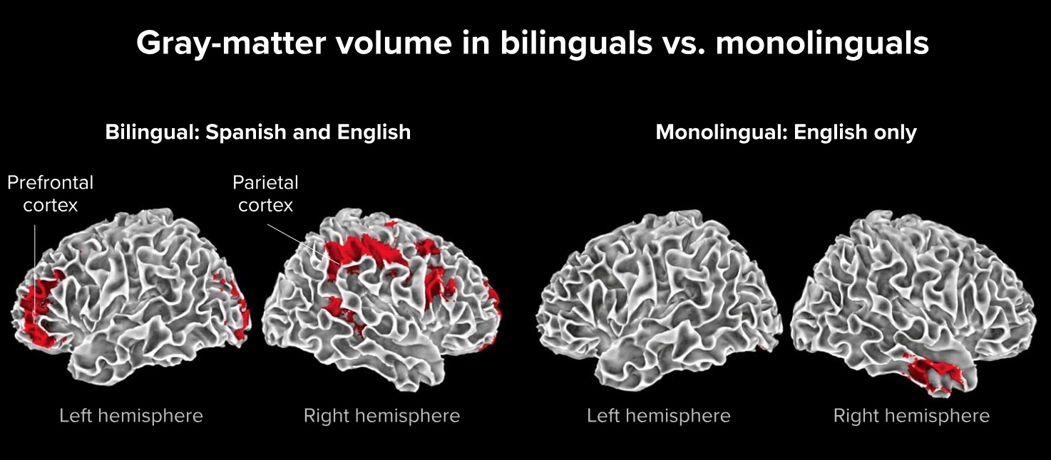 A comparison of the same brain.