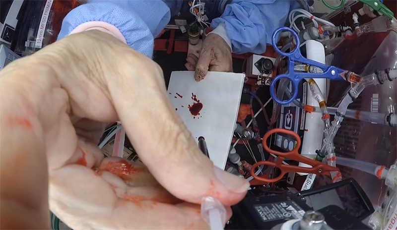 A close-up view of a hand with splatters of blood, manipulating electronic components and tools on a cluttered work surface.