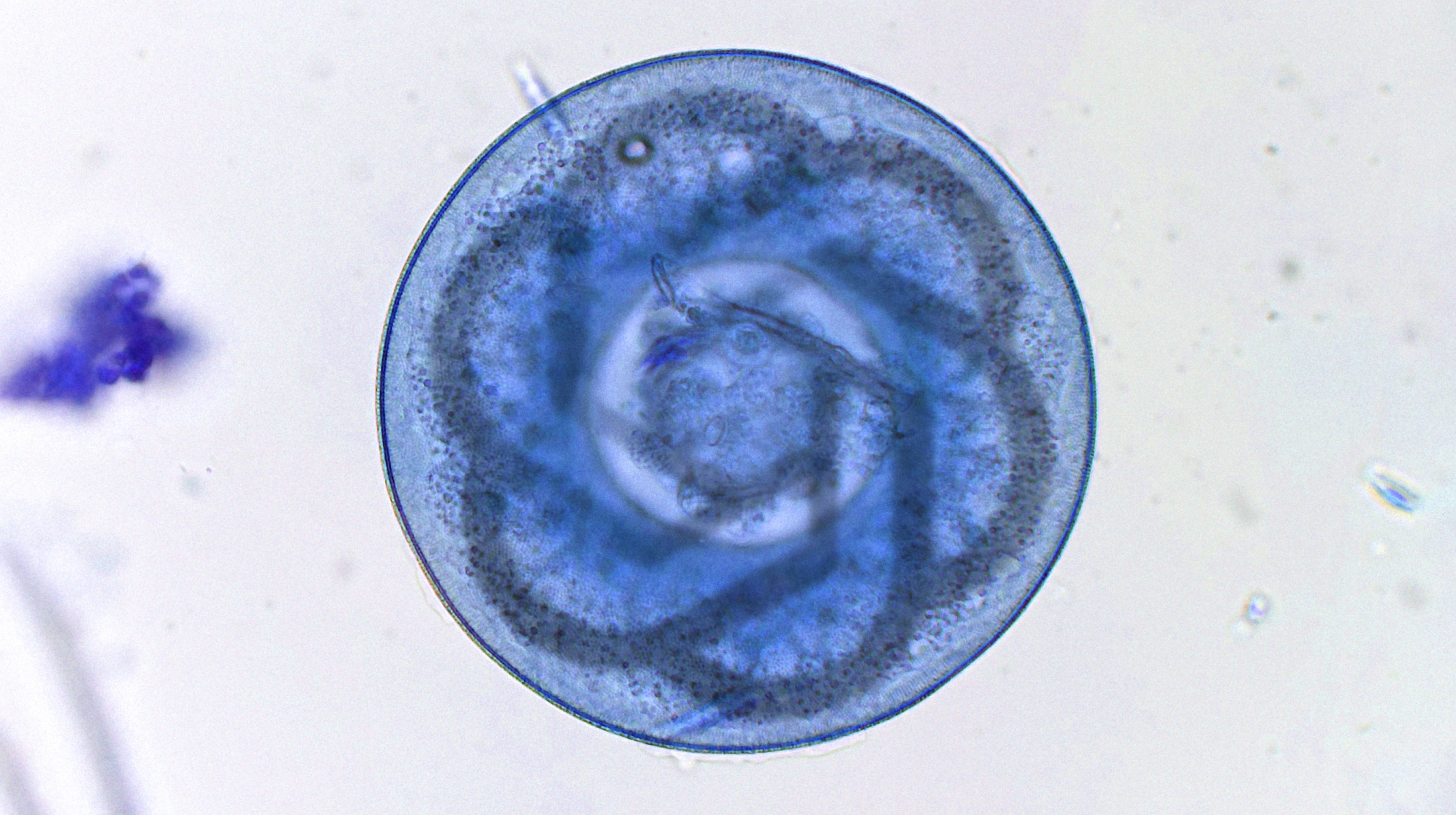 Microscopic view of a translucent, spiral-shaped Trichinella spiralis larva within a blue-stained muscle tissue.